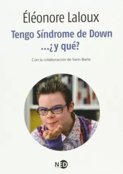 Tengo sindrome de down, y que?