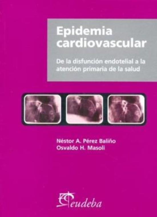Epidemia cardiovascular