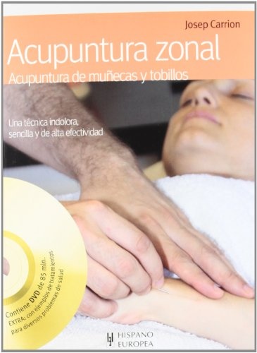 Acupuntura zonal