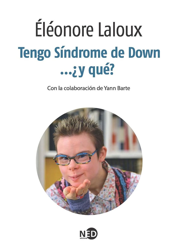 Tengo sindrome de down, y que?